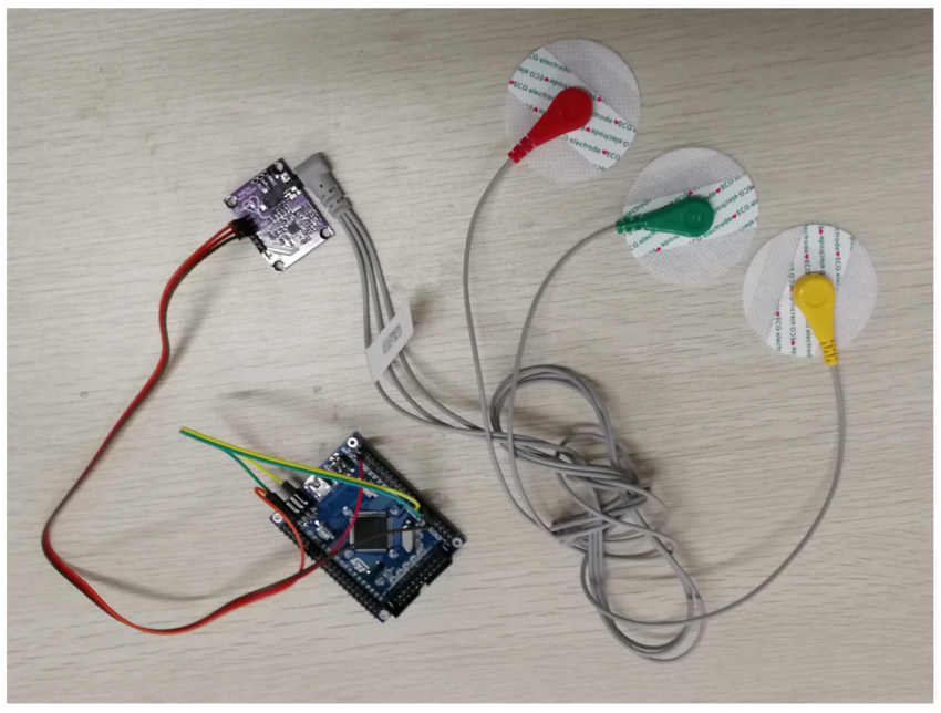 Biomedical signal processing ECG EEG MATLAB lab Bangalore