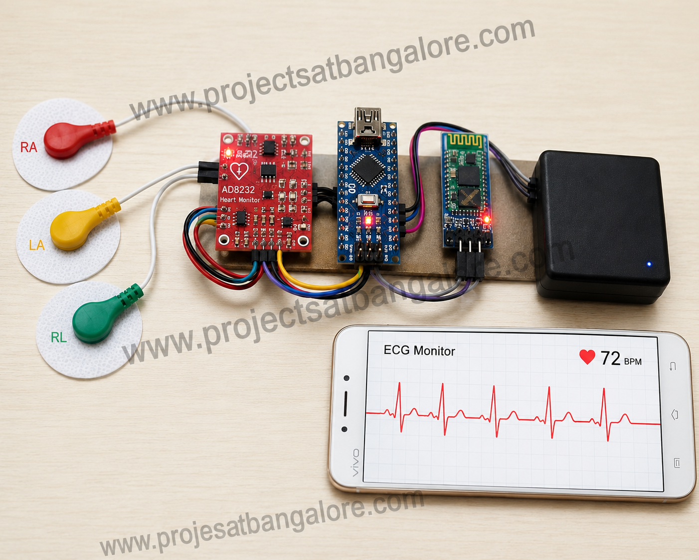 Arduino wearable health IoT monitoring biomedical project Bangalore
