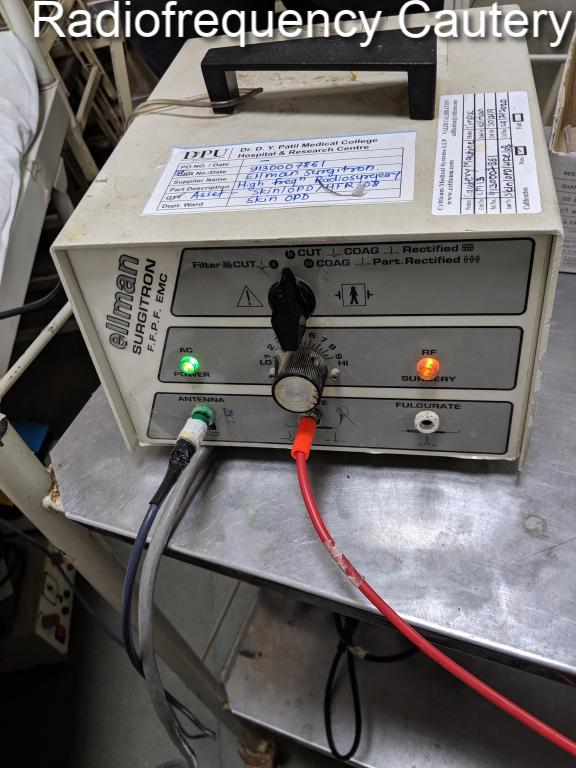 ICU patient monitoring hospital automation project Bangalore
