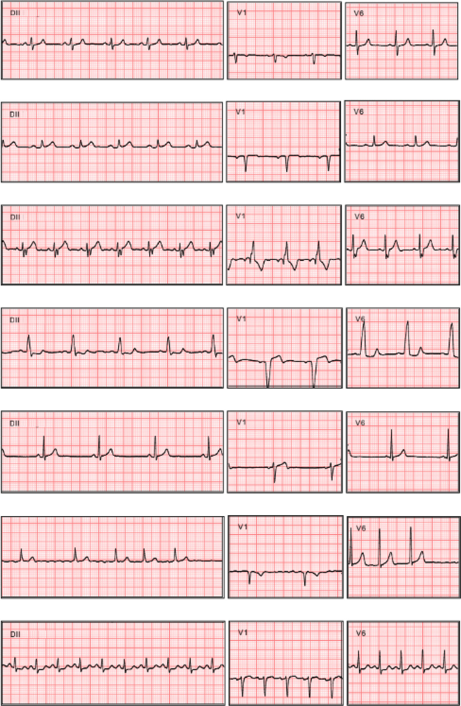 12-lead-ecg-acquisition Diagram