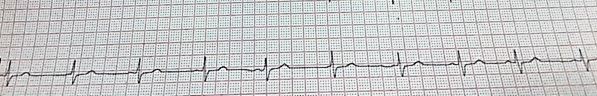 ad8232-heart-rate-monitor Diagram