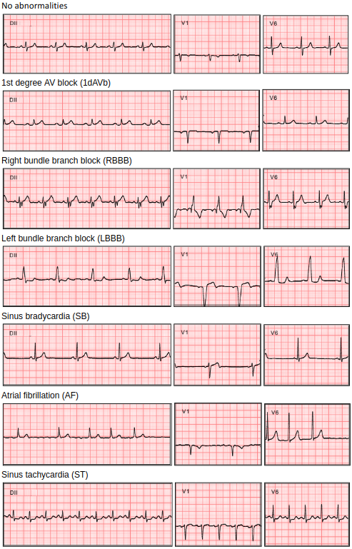 ads1298-multi-lead-ecg Diagram