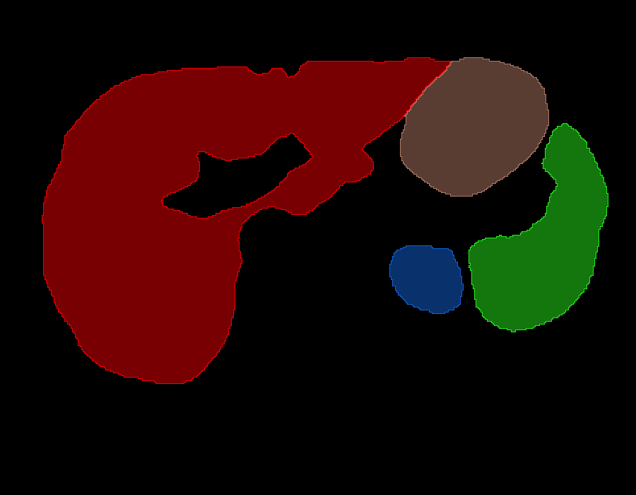 ansys-abdominal-injury-model Diagram