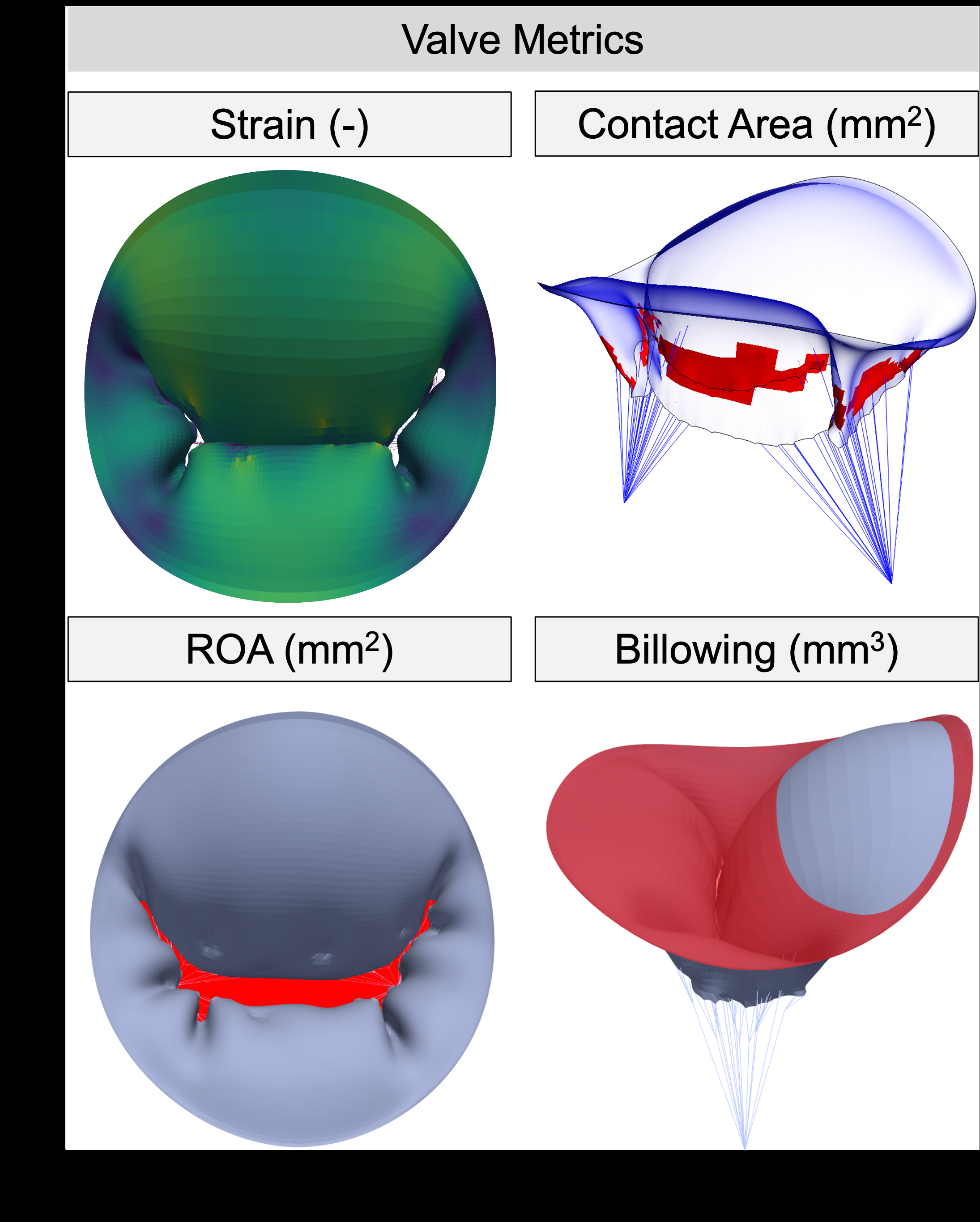 ansys-chordae-tendineae-model Diagram