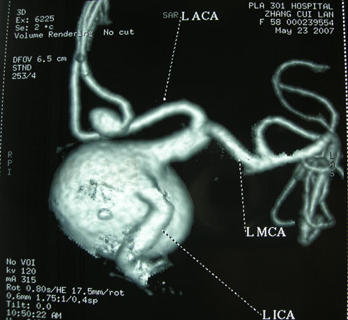 ansys-dicom-to-3d-model Diagram