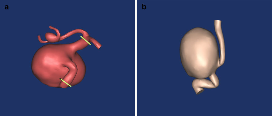ansys-dicom-to-3d-model Diagram