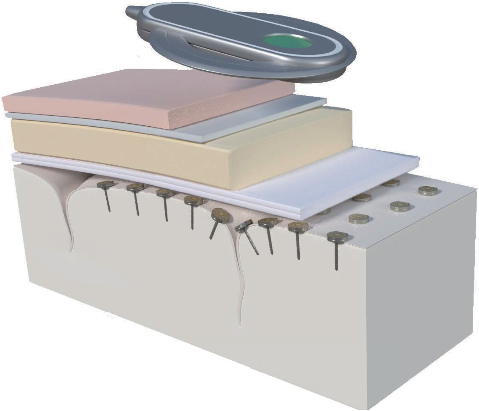ansys-implantable-device-hermeticity Diagram