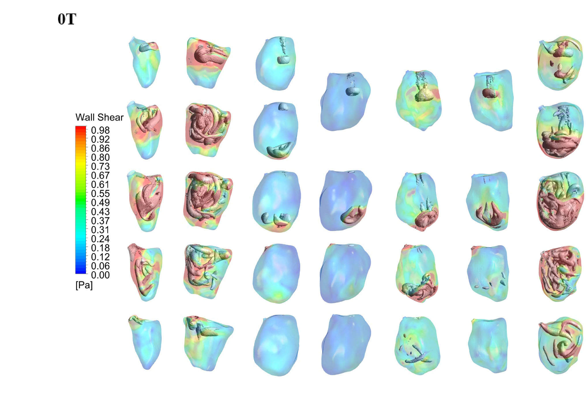 ansys-left-ventricle-mechanics Diagram