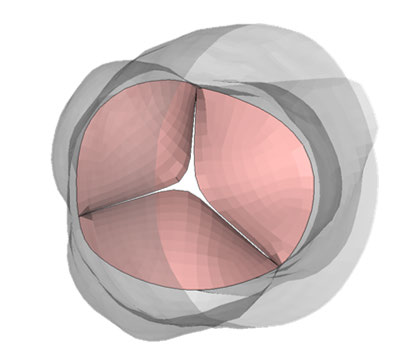 ansys-pericardium-mechanics Diagram