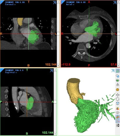 ansys-pericardium-mechanics Diagram