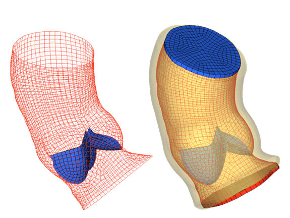 ansys-pericardium-mechanics Diagram
