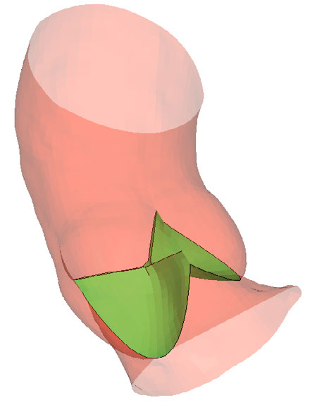 ansys-pericardium-mechanics Diagram