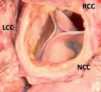ansys-pericardium-mechanics Diagram