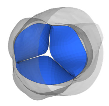 ansys-pericardium-mechanics Diagram