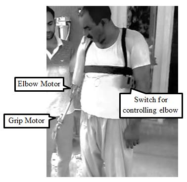 ansys-prosthetic-limb-analysis Diagram