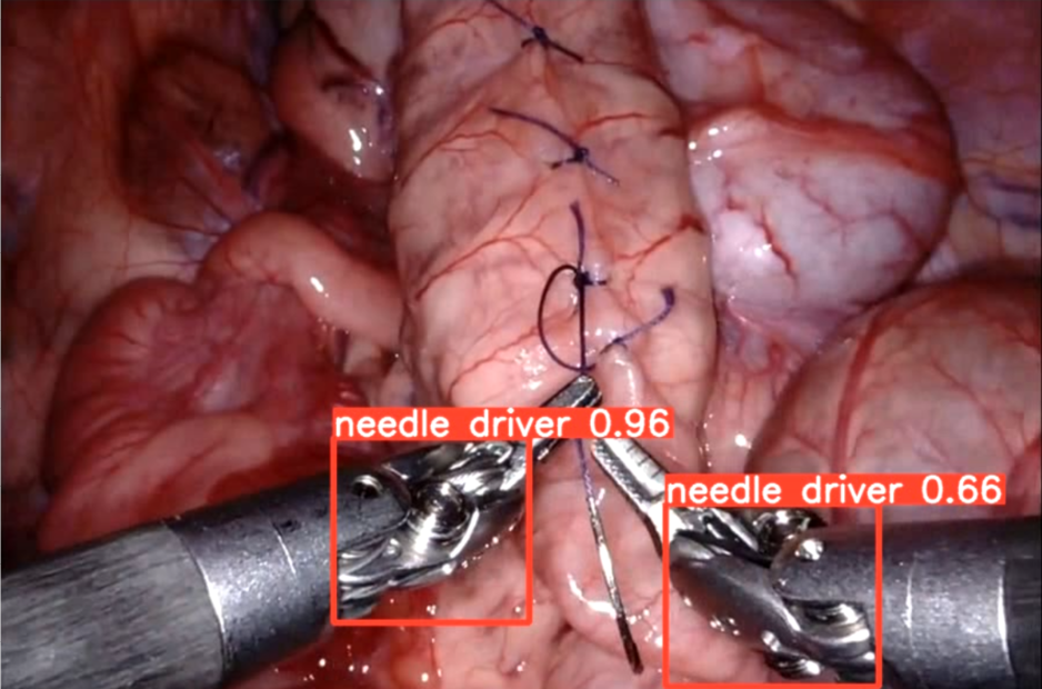 ansys-surgical-instrument-stress Diagram