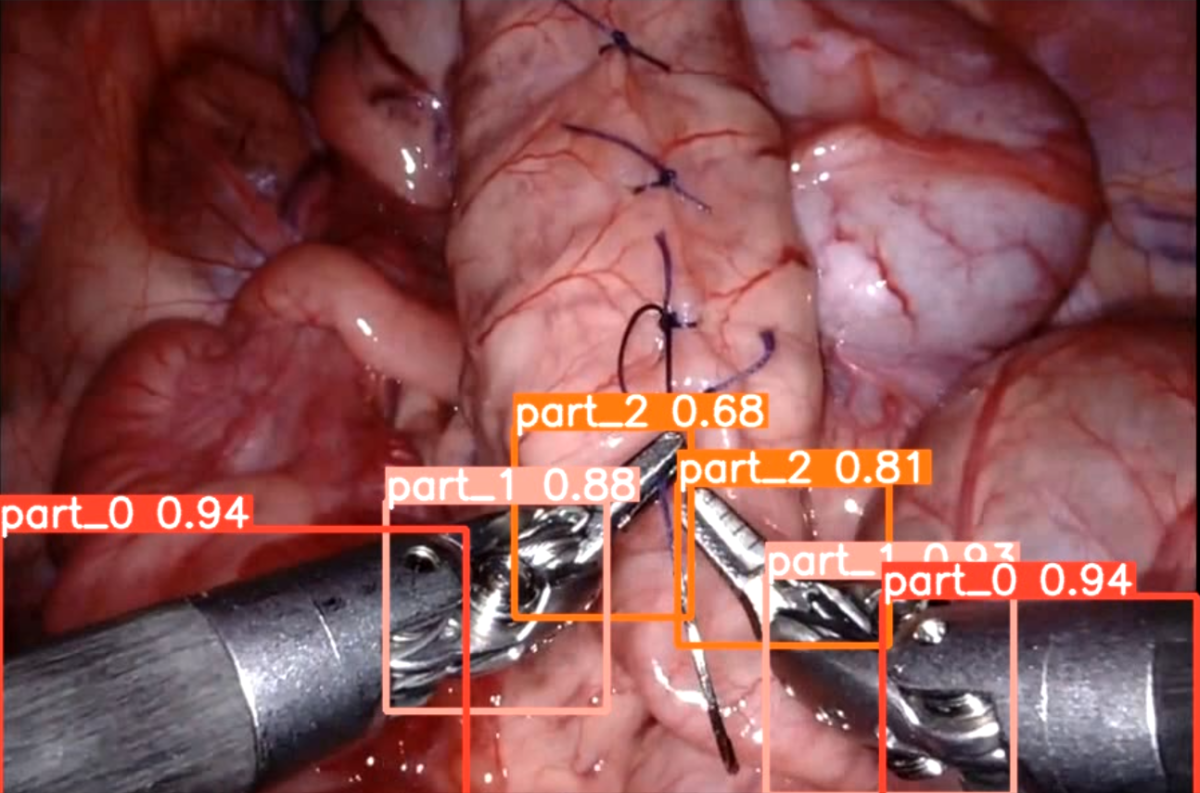 ansys-surgical-instrument-stress Diagram