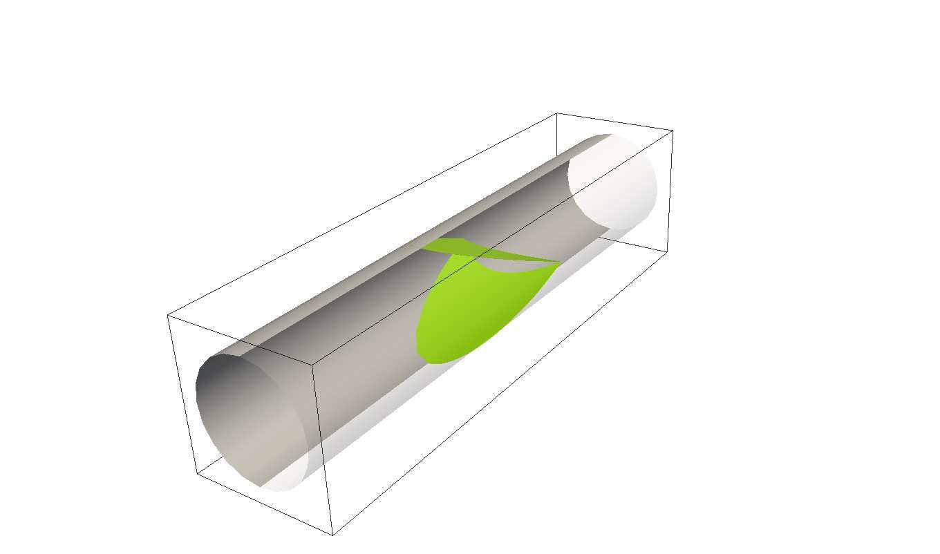 ansys-valve-leaflet-stress Diagram
