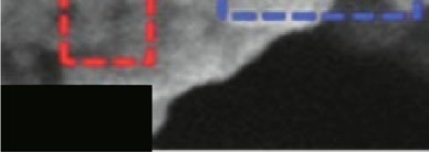 blood-gas-analyzer-sensor Diagram