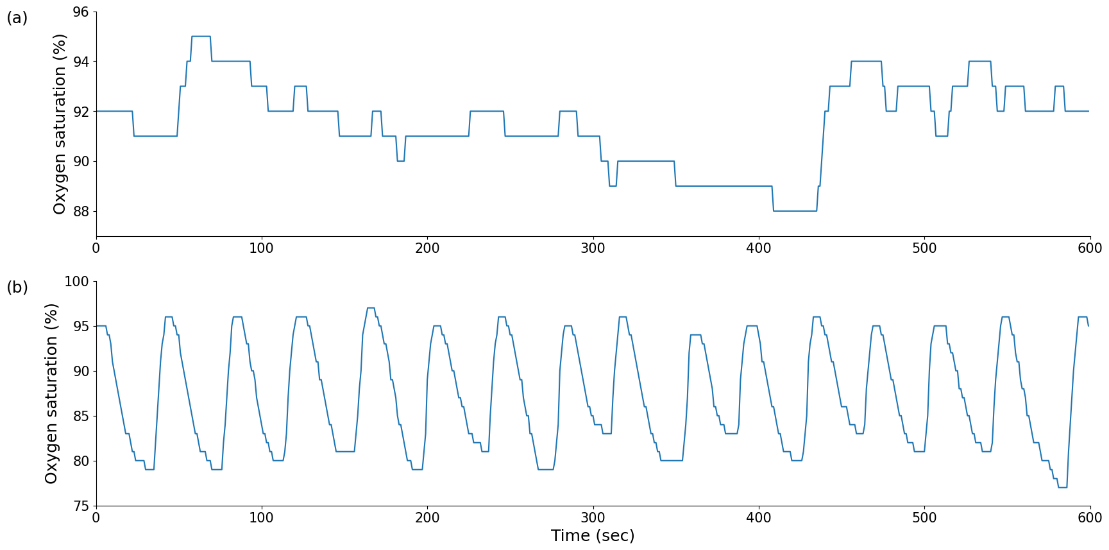 cerebral-oximetry-nirs Diagram