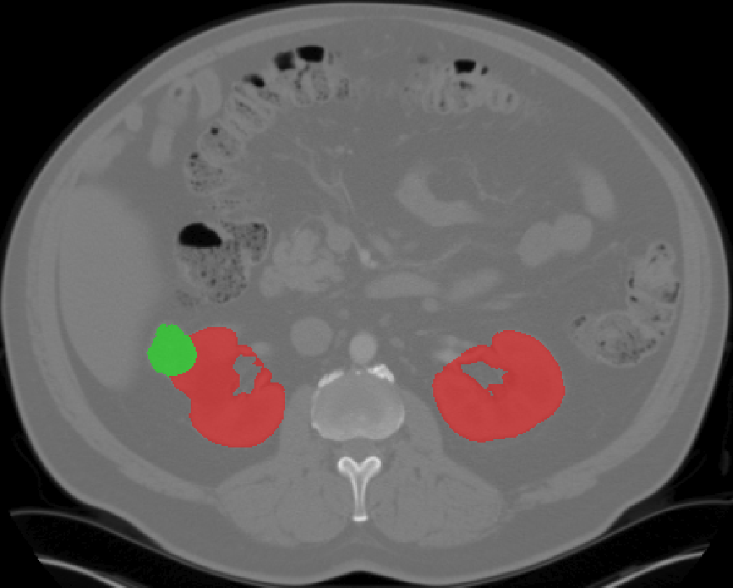 comsol-artificial-kidney-model Diagram