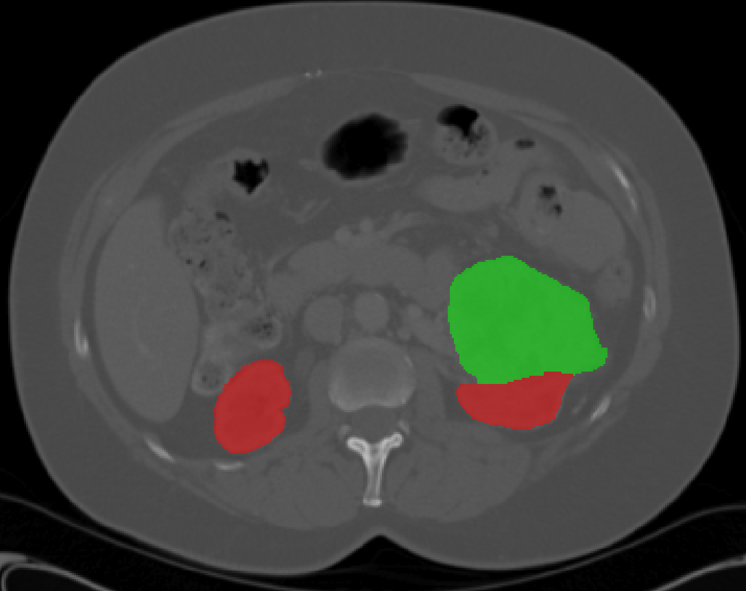 comsol-artificial-kidney-model Diagram