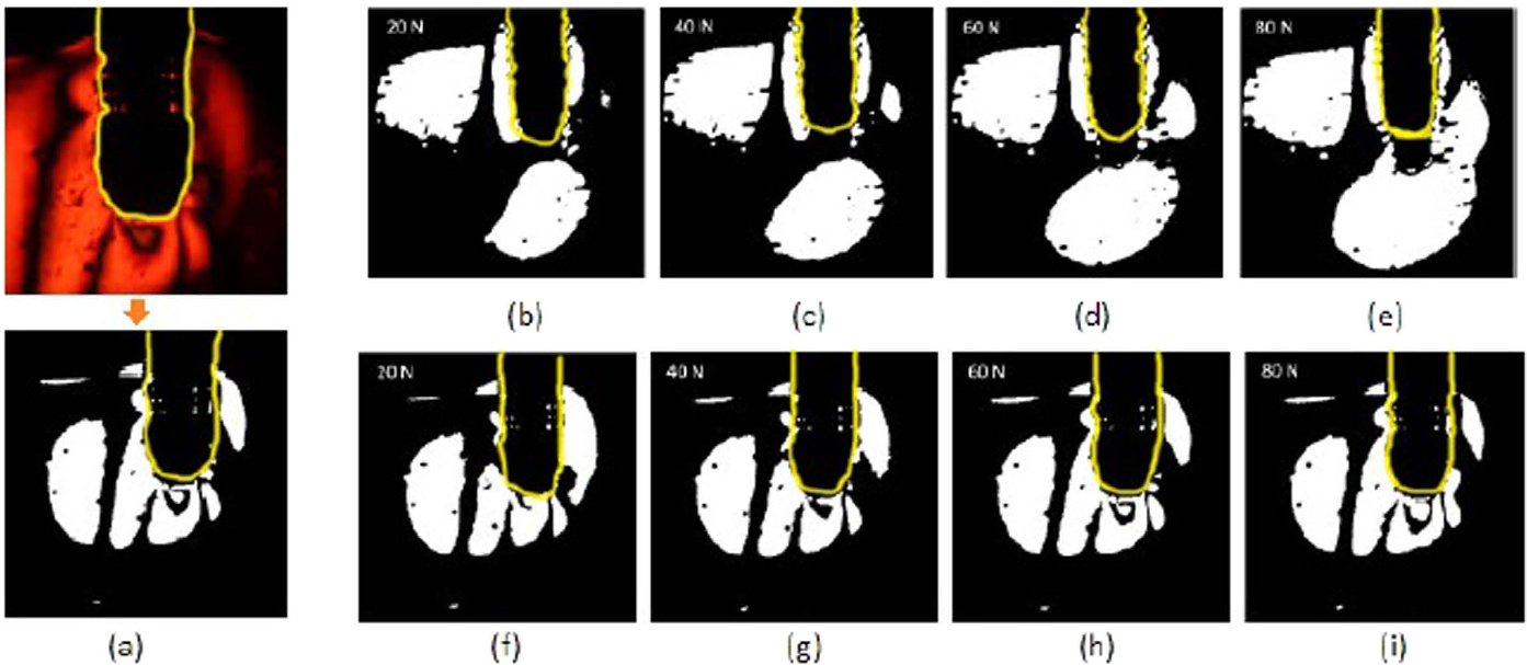 comsol-dental-implant-analysis Diagram