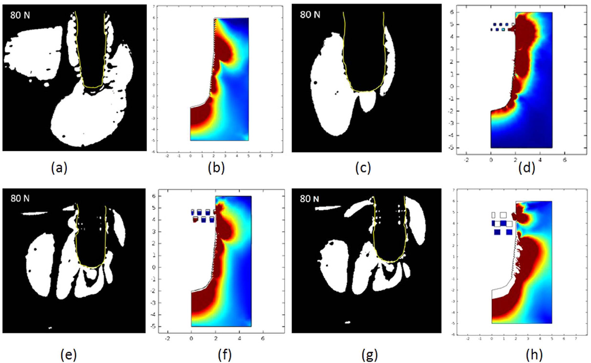 comsol-dental-implant-analysis Diagram