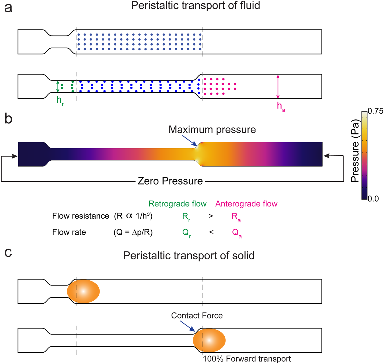 comsol-infusion-set-flow Diagram