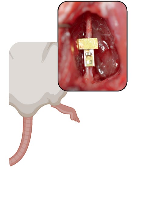 comsol-mri-safety-implant Diagram