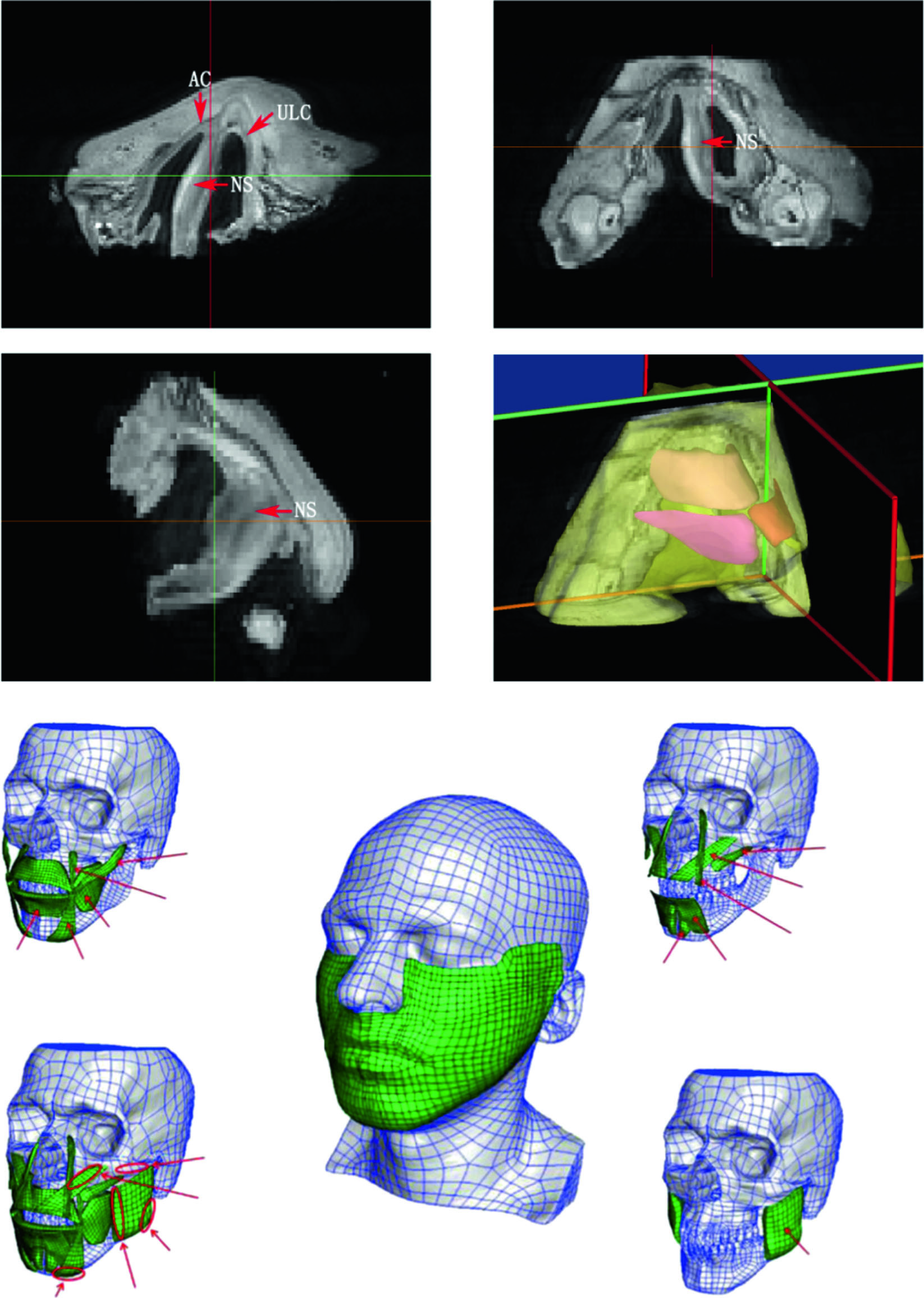 comsol-nasal-airflow-analysis Diagram