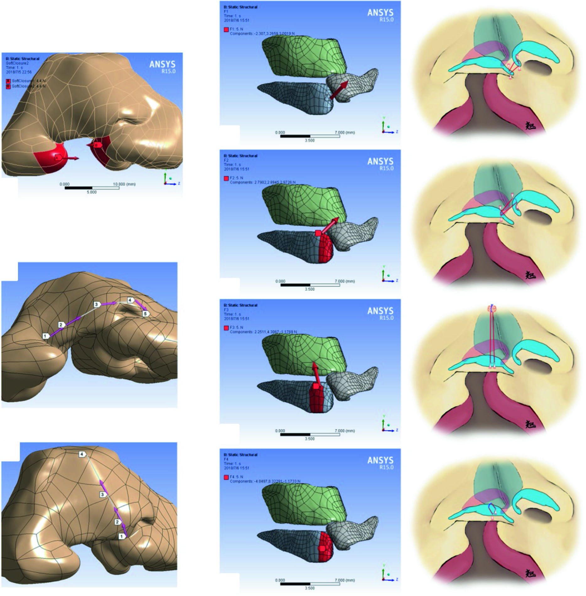 comsol-nasal-airflow-analysis Diagram