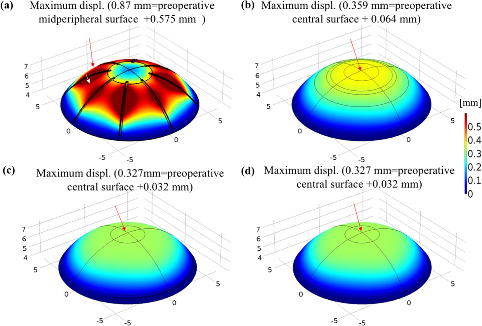 comsol-ocular-biomechanics Diagram