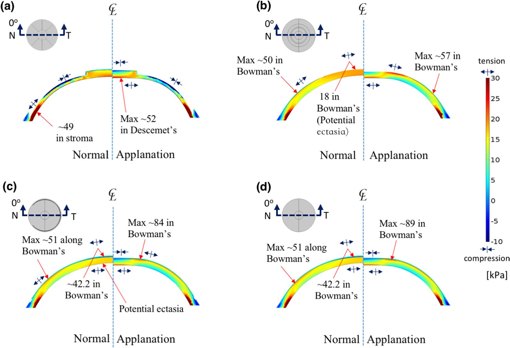comsol-ocular-biomechanics Diagram