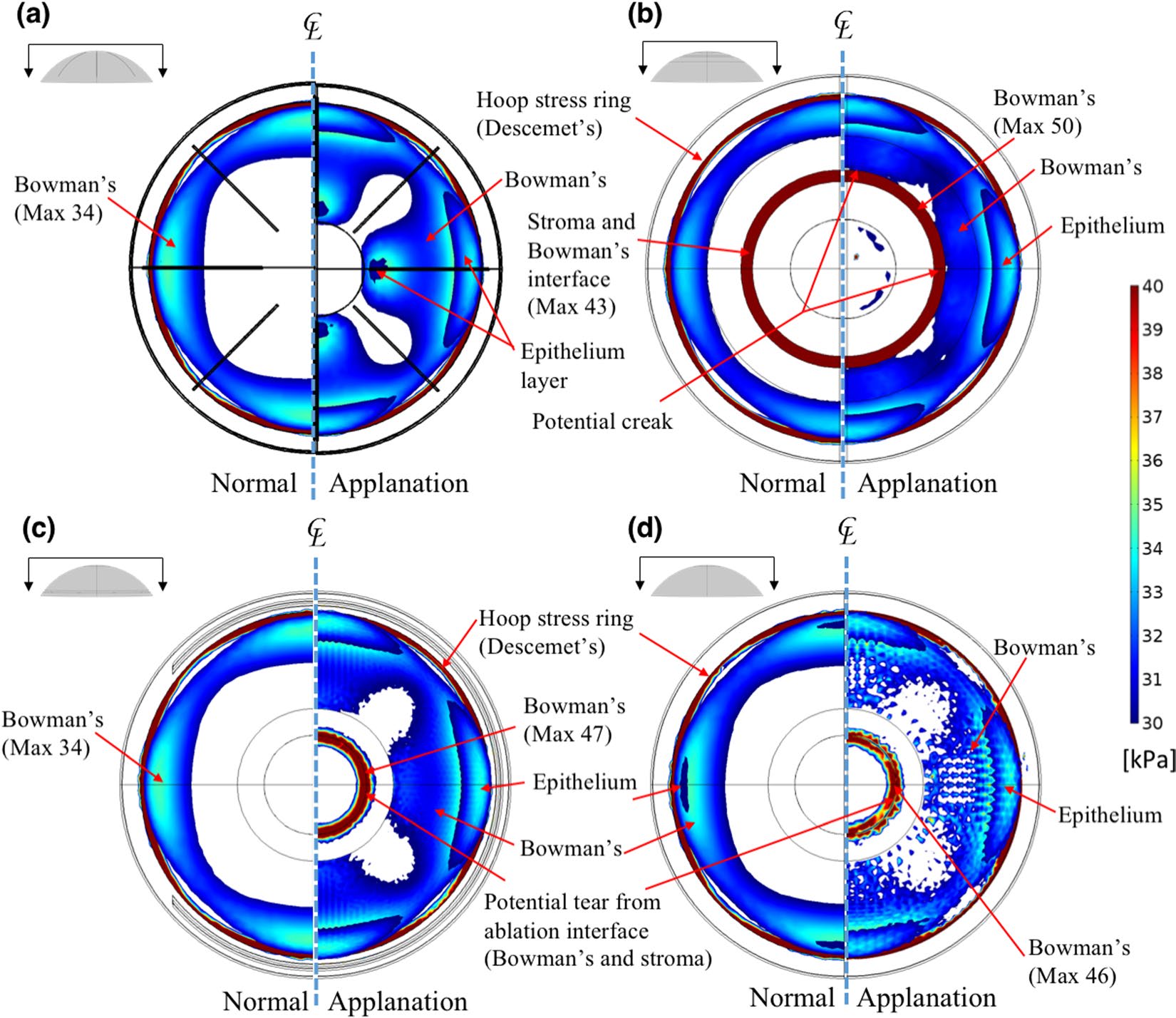 comsol-ocular-biomechanics Diagram