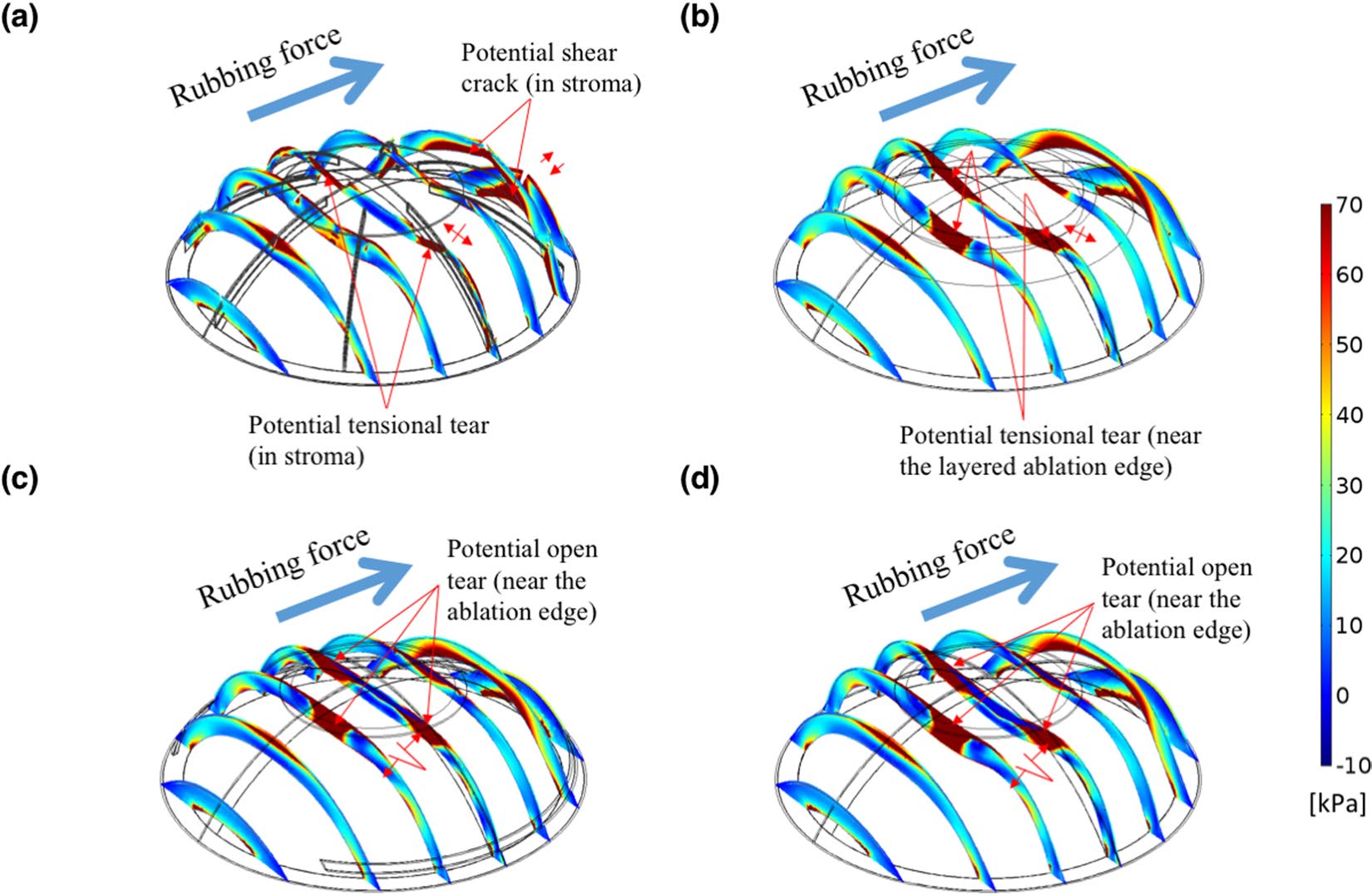 comsol-ocular-biomechanics Diagram