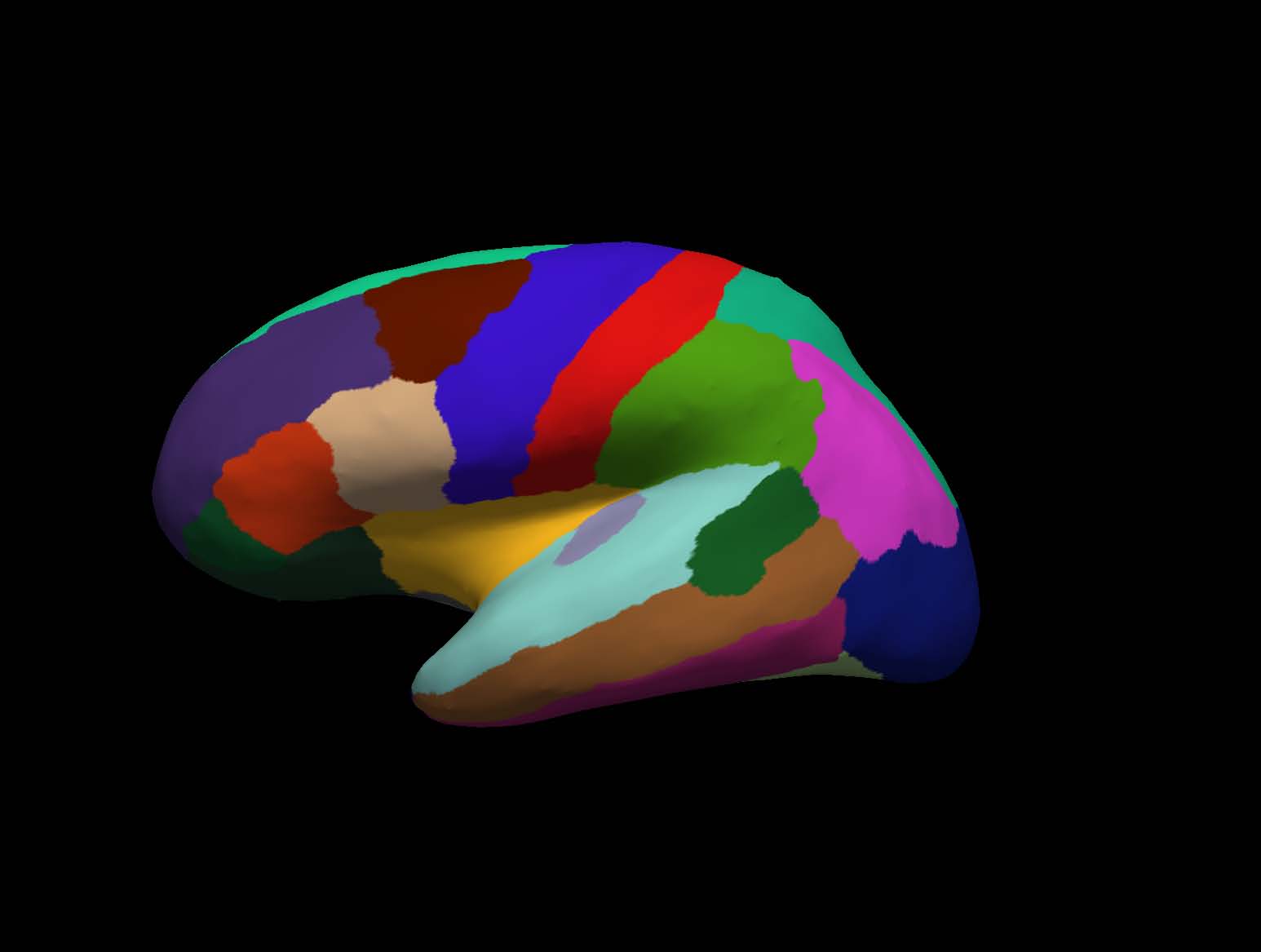 cortical-electrode-interface Diagram