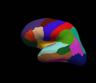 cortical-electrode-interface Diagram