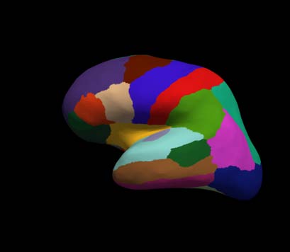 cortical-electrode-interface Diagram