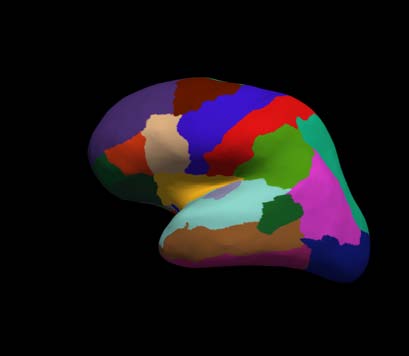 cortical-electrode-interface Diagram
