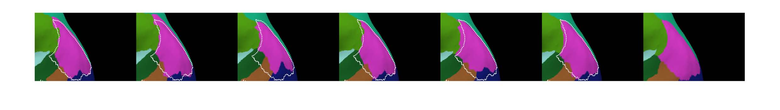 cortical-electrode-interface Diagram