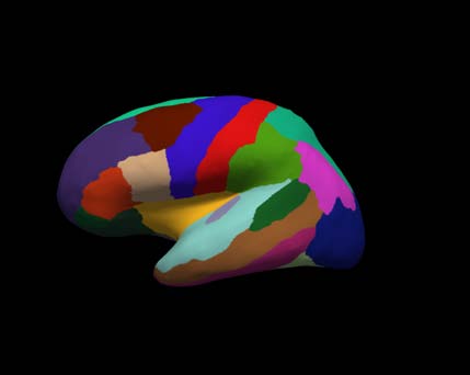 cortical-electrode-interface Diagram