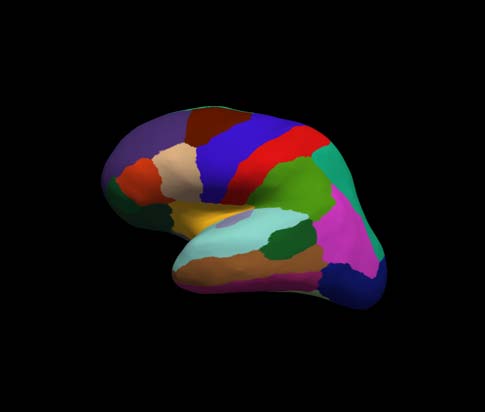cortical-electrode-interface Diagram
