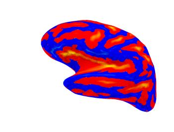 cortical-electrode-interface Diagram
