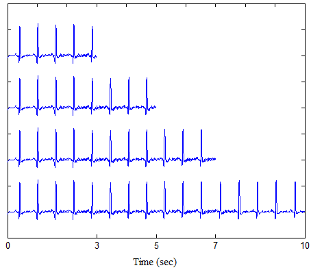 ecg-sensor-based-heart-rate-monitor Diagram