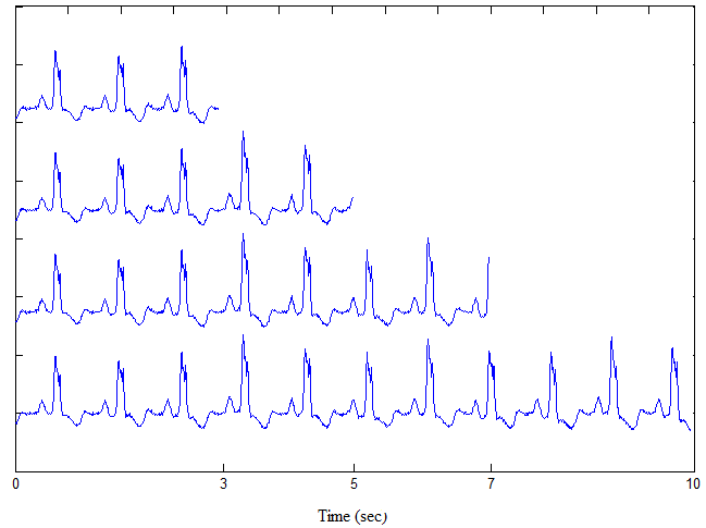 ecg-sensor-based-heart-rate-monitor Diagram