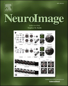 eeg-neurofeedback-system Diagram