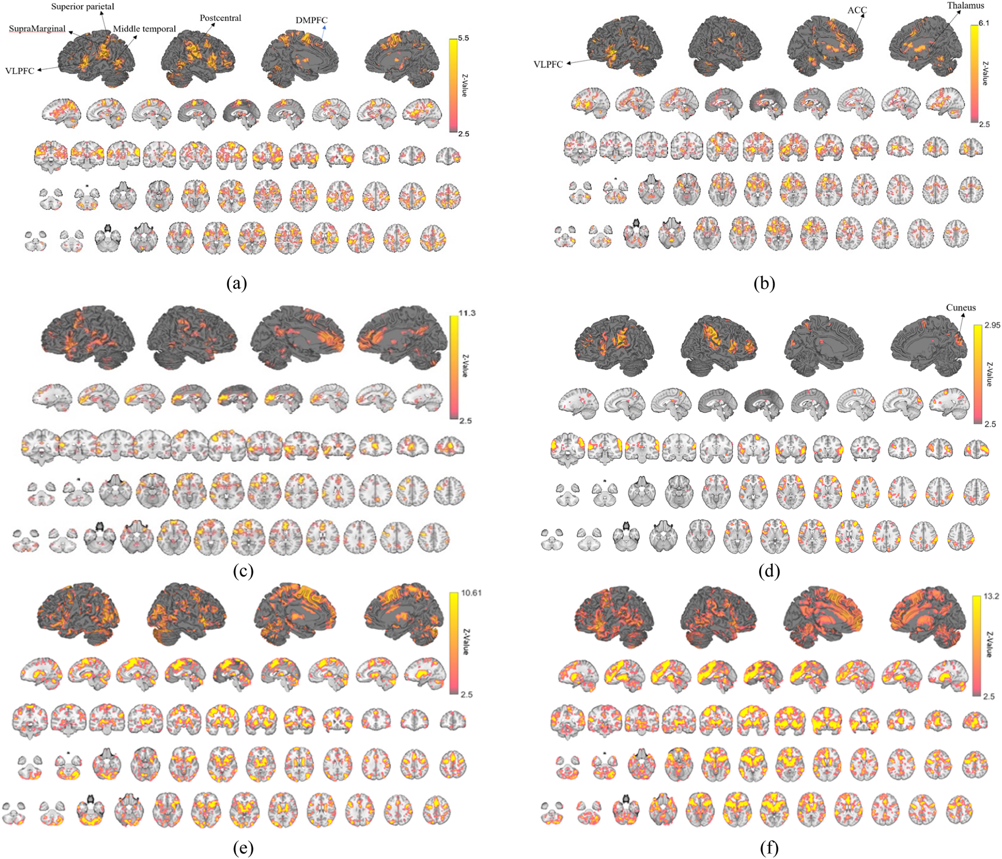 eeg-neurofeedback-system Diagram