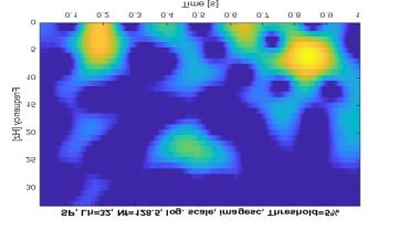 eeg-signal-acquisition-system Diagram