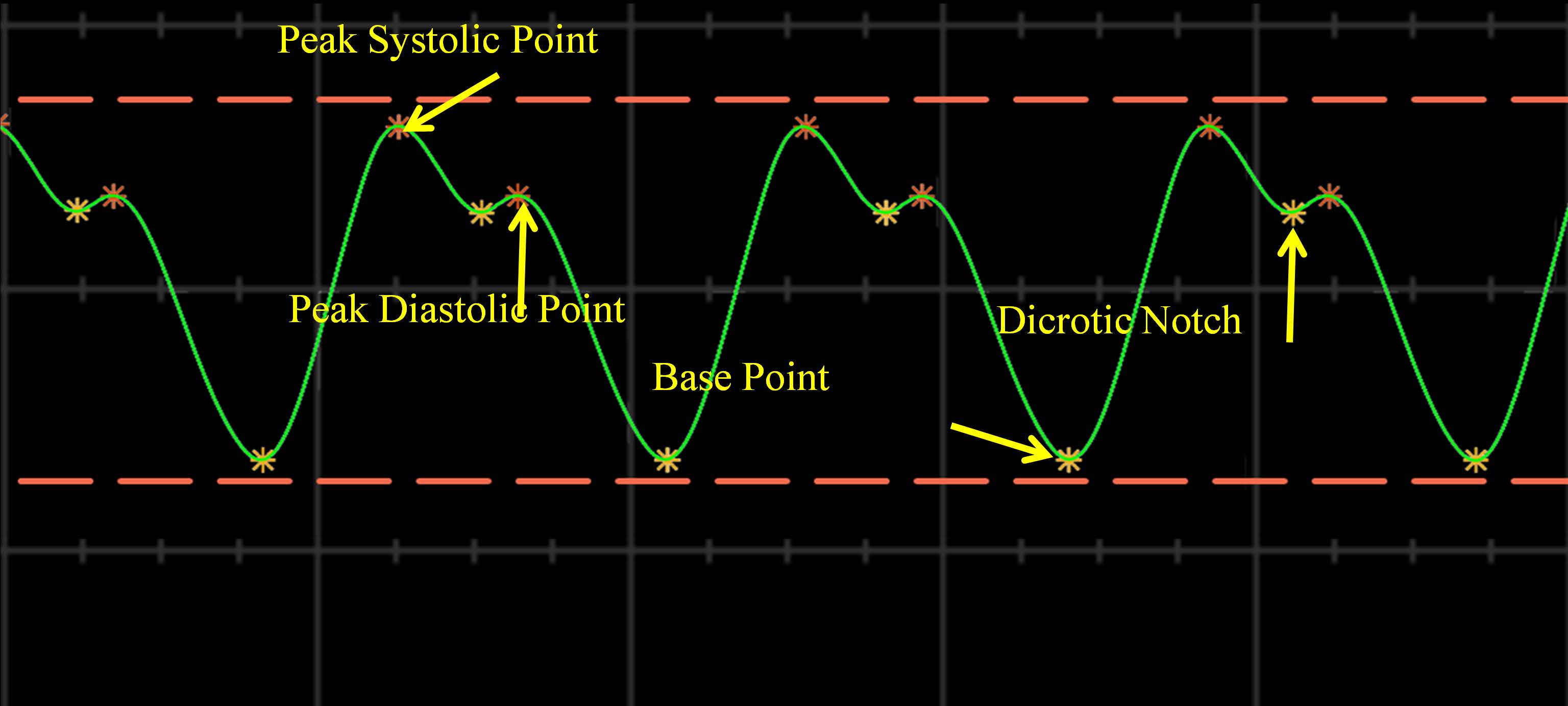 impedance-cardiography-icg Diagram